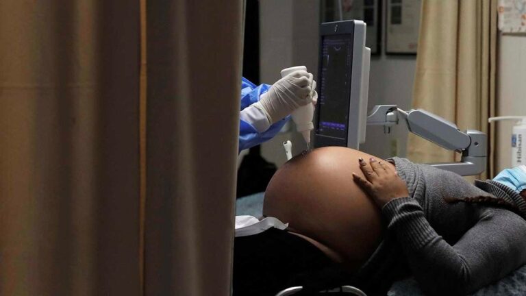 MAMA EMBARAZADA EN CONTROLES