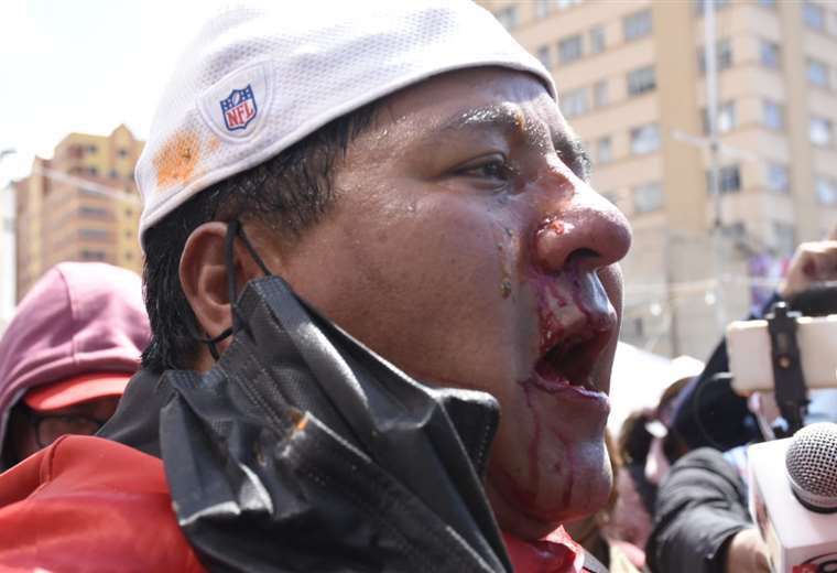 agresin-a-maestros-en-la-paz-foto-apg-noticias_1461404200_760x520