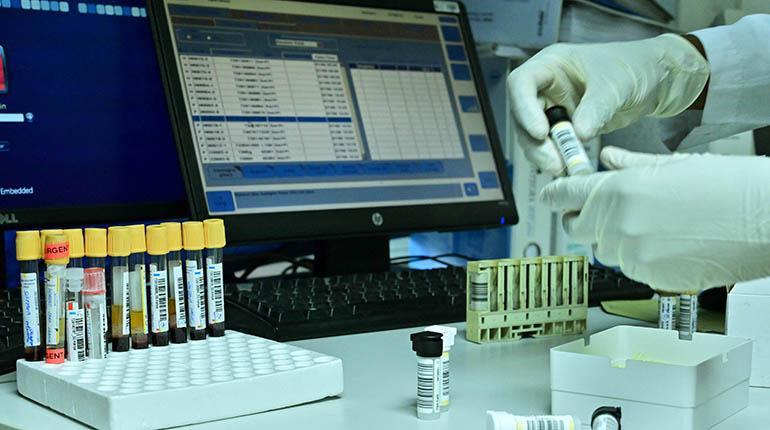 hongo negro laboratorio